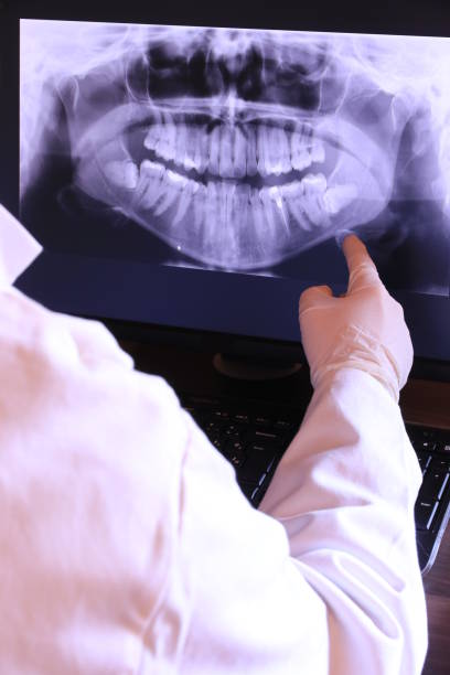 Best Emergency Wisdom Teeth Removal in Pajaro, CA
