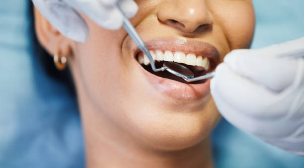 Best Emergency Dental Care for Broken or Chipped Teeth in Pajaro, CA